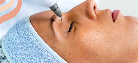 Para Que Serve O Jato De Plasma - Jato de Plasma para Rejuvenescimento: Como Funciona e Quais Resultados ...