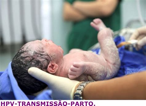 Hpv Passa Para O Bebe - Innaldo Sardinha: HPV PODE SER TRANSMITIDO AO BEBÊ DURANTE O PARTO...