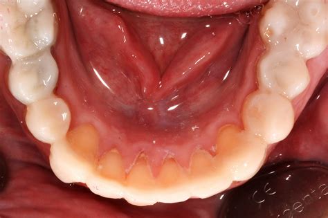 Abrasion on Behance