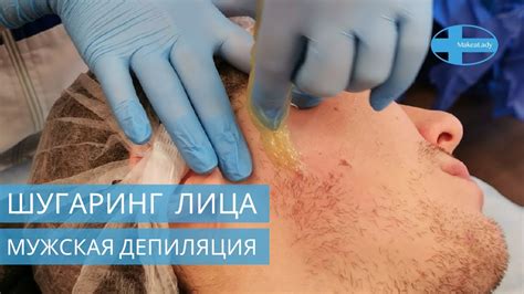 Мужская сахарная депиляция Зона лица. Обучение с сертификатом. Видео ...