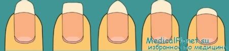 Как сделать красивую форму ногтей? - практичные советы