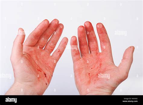 hand cut blood bleeding  res stock photography  images alamy