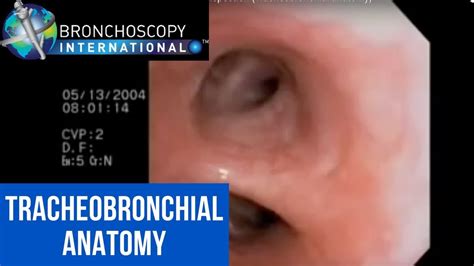 Flexible Bronchoscopy Introduction 7 - Airway Inspection ...