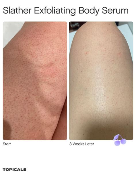 skincare products  women skincare topicals