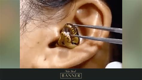 Viral Video: “Surgeon” Attempts To Extract A Live Snake From A Woman’s ...
