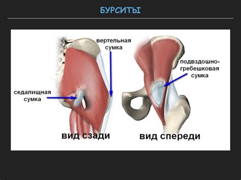 Визуализация тазобедренного сустава