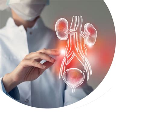 Urology Hospital, Amravati | Best Urology Treatment, Amravati
