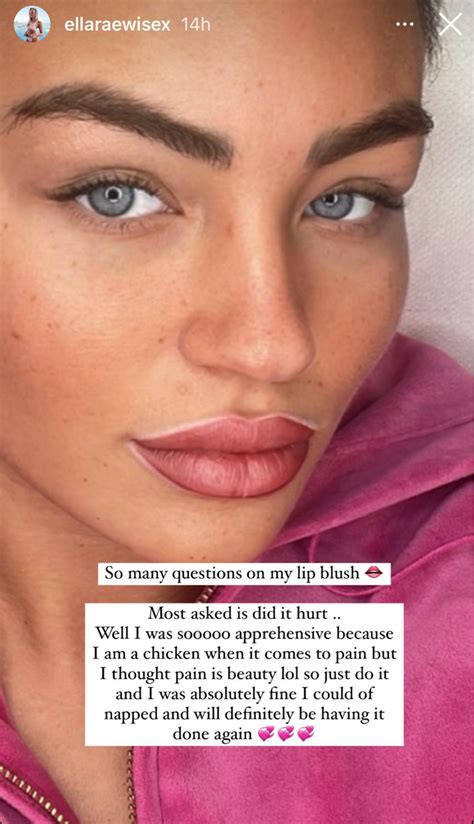 TOWIE’s Ella Rae Wise shows off ‘unreal’ lip transformation ahead of