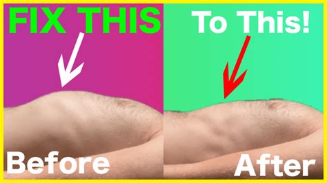 Rib Flare – FIX It for Good – ZacCupples.com