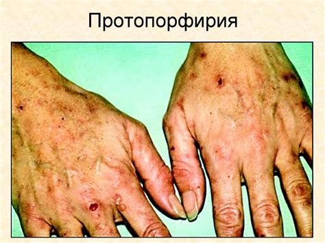 Про болезни в мифологии - презентация онлайн
