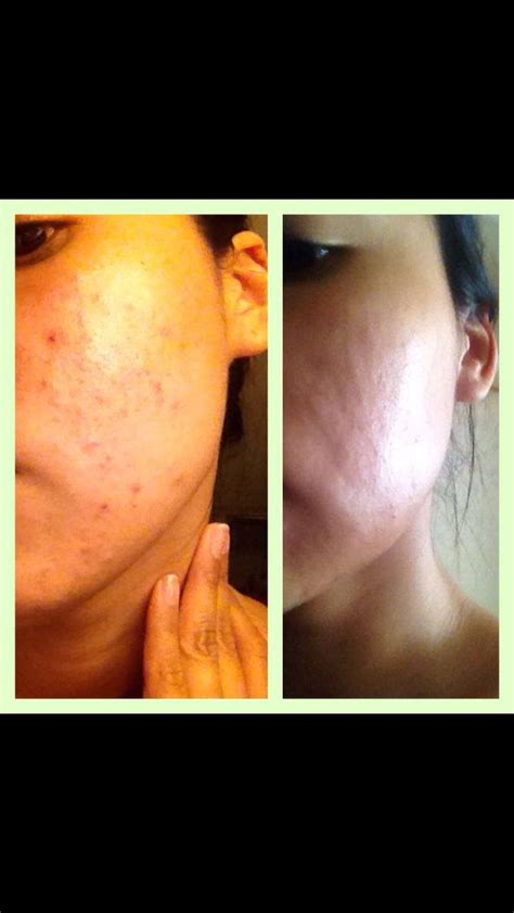 True science skin regimen 30 days !AHHHHmazing. Order now or become a ...