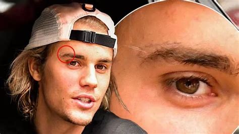 Justin Bieber gets a tattoo on his FACE in tribute to wife Hailey ...