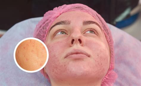 what causes flushing on face 6