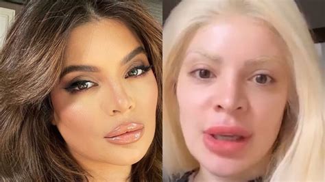 Antes E Depois Gkay - Foto: O antes e depois de Gkay agitou a web - Purepeople
