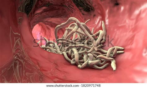 2,315 Ascaris Images, Stock Photos, 3D objects, & Vectors | Shutterstock