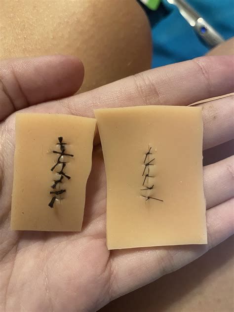 The difference between silk(left) and nylon(right) sutures : r ...
