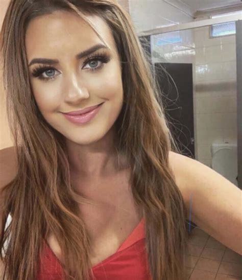 Australian woman struck by roller coaster, left in a coma