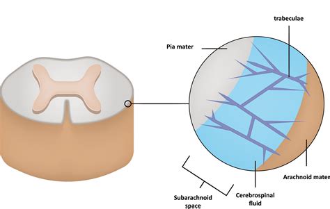 About spinal CSF leak - spontaneous intracranial hypotension — SPINAL