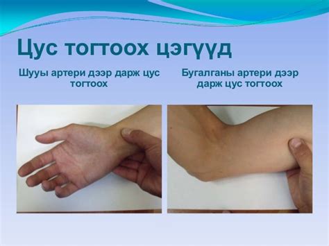 цус алдалтын үед авах арга хэмжээ