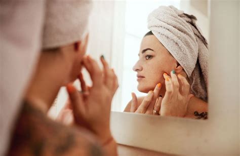 chiazze bianche sulla pelle union mistery