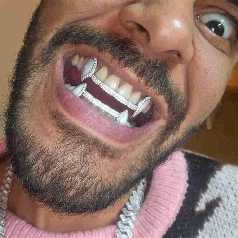 women grillz icegiant