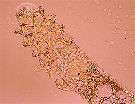 Demodex folliculorum adulto - Compendio de imágenes de Oftalmología