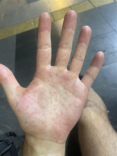 what does it mean if your hand itches