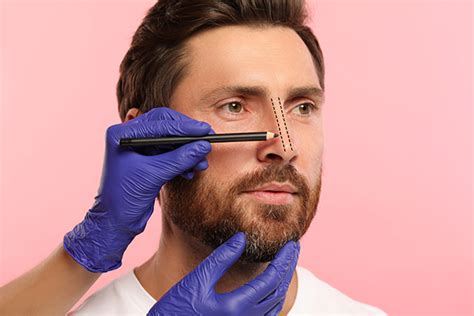 male rhinoplasty  ireland nose surgery  men