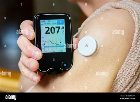 Needle-free blood glucose meter Stock Photo - Alamy