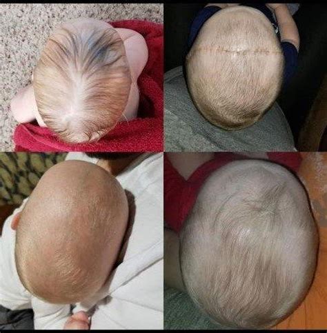 headbefore   healthyu