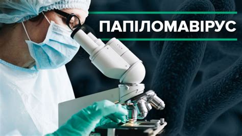 Вірус папіломи людини: все про статеве захворювання, яким інфіковані 80 ...