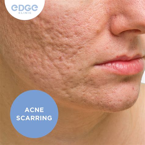 EDGE CLINIC - Home | Facebook