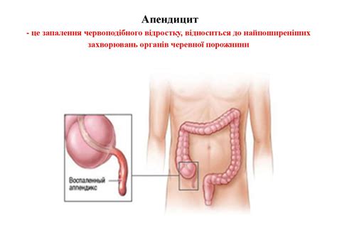 Догляд за хворими з хірургічними захворюваннями та ушкодженнями органів ...