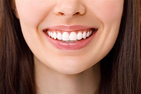 KöR Teeth Whitening in Alexandria, VA | Old Town Dentistry | KöR Teeth