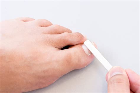vertical line in toenail 1
