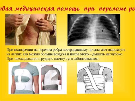 Наложение повязки при переломе ребра: как сделать корсет из бинта