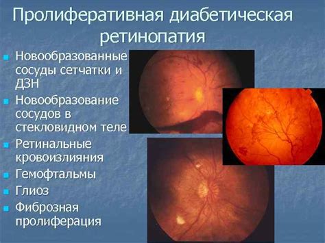 Изменения органа зрения при общих заболеваниях Офтальмоонкология