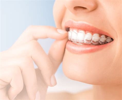 Invisalign®, Cornwall