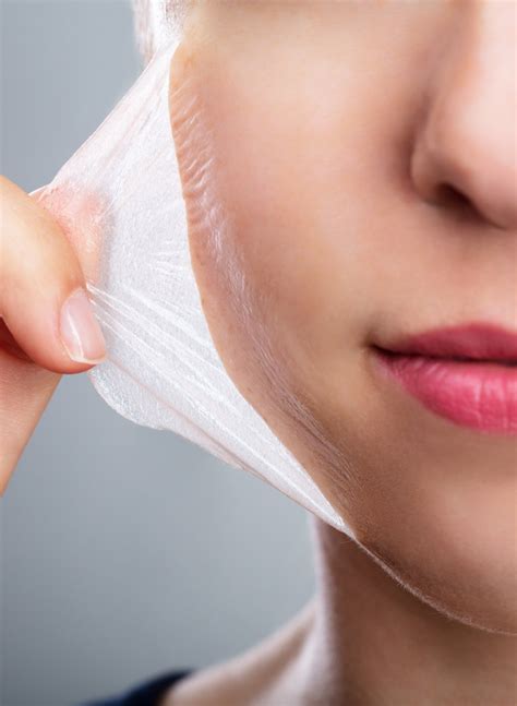 Chemisches Peeling – Microneedling | Dr. Marta Tilscher