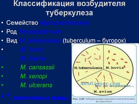 Туберкулёз. Дифтерия - презентация онлайн