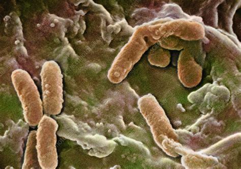 Pseudomonas aeruginosa bacteria, SEM - Stock Image - B220/1614 ... 