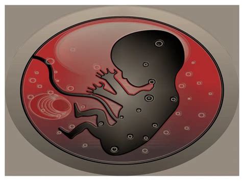 What Does It Mean To Dream About Abortion? - StuffSure