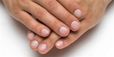 Bruzdy na paznokciach – co je powoduje? | Diag.pl