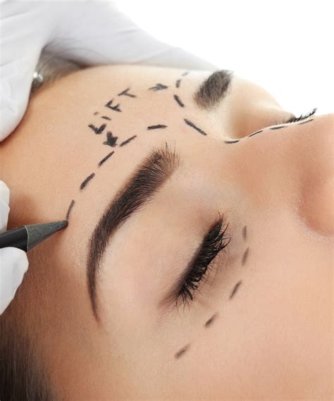 Eyebrow Lift – Allesta Health Group