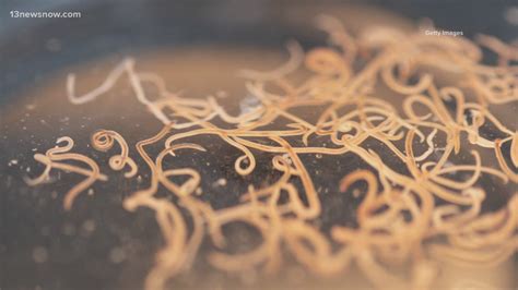 Roundworms In Humans