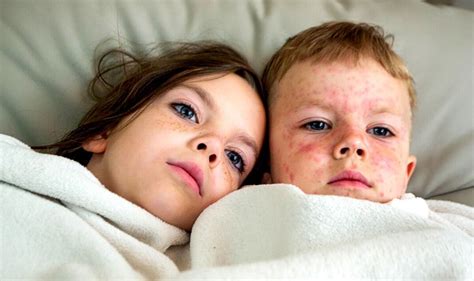 'A child died last week': Deadly and contagious virus is circulating ...