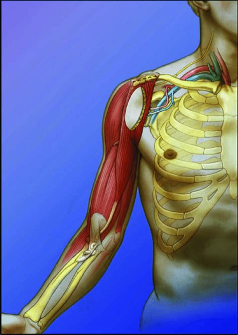 Schematic illustration shows a technique for single elbow flexion ...