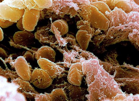 Plague Bacteria Photograph by Niaid/cdc/science Photo Library