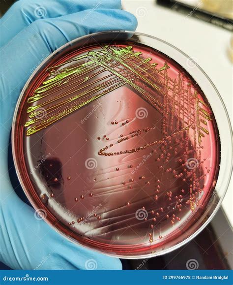 Escherichia Coli Bacteria Growth on Eosin Methylene Blue Agar Stock
