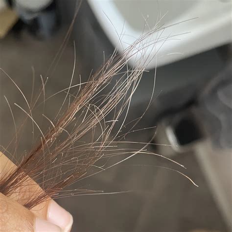 Hair Strands Turning White at Anita Thompson blog